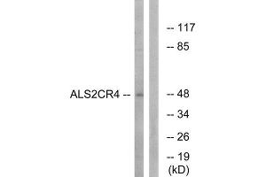 Western Blotting (WB) image for anti-Transmembrane Protein 237 (TMEM237) (Internal Region) antibody (ABIN1850756) (TMEM237 Antikörper  (Internal Region))