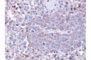 IHC-P Image Immunohistochemical analysis of paraffin-embedded SAS xenograft, using PPP1CC, antibody at 1:100 dilution. (PPP1CC Antikörper  (Center))