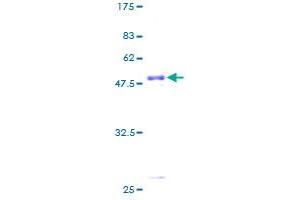 Image no. 1 for Pallidin Homolog (PLDN) (AA 1-172) protein (GST tag) (ABIN1315359) (Pallidin Protein (AA 1-172) (GST tag))