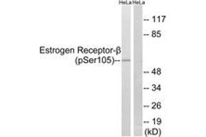Western blot analysis of extracts from HeLa cells, using Estrogen Receptor-beta (Phospho-Ser105) Antibody. (ESR2 Antikörper  (pSer105))