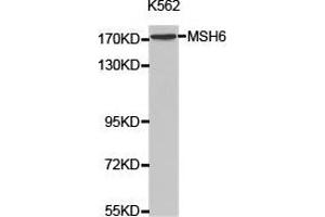 Western Blotting (WB) image for anti-MutS Homolog 6 (E. Coli) (MSH6) antibody (ABIN1873754) (MSH6 Antikörper)