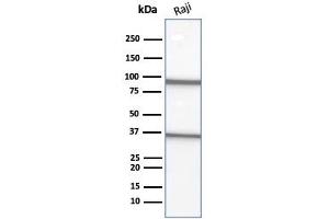 Western Blot Analysis of Raji cell lysate using CD20 Mouse Monoclonal Antibody (L26). (CD20 Antikörper)