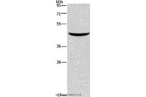 Western blot analysis of Mouse pancreas tissue, using GIPR Polyclonal Antibody at dilution of 1:150 (GIPR Antikörper)