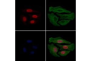 ABIN6256332 and ABIN6267233 staining Hela cells(4h of LPS treatment) by IF/ICC. (HDAC3 Antikörper  (pSer424))