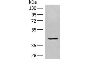 Western blot analysis of A549 cell lysate using GPR62 Polyclonal Antibody at dilution of 1:350