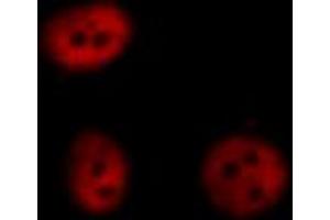 Immunofluorescence (fixed cells) (IF/ICC) image for anti-Nuclear Factor of kappa Light Polypeptide Gene Enhancer in B-Cells 1 (NFKB1) (pSer927) antibody (ABIN6256451)