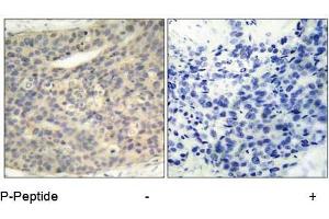Image no. 1 for anti-LIM Domain Kinase 1 (LIMK1) (pThr508) antibody (ABIN196830) (LIM Domain Kinase 1 Antikörper  (pThr508))