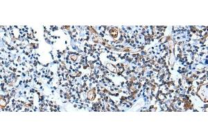 Immunohistochemistry of paraffin-embedded Human tonsil tissue using USP37 Polyclonal Antibody at dilution of 1:45(x200) (USP37 Antikörper)