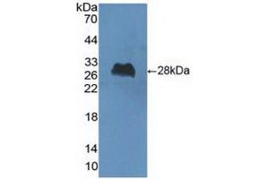 Detection of Recombinant ChAT, Human using Polyclonal Antibody to Choline Acetyltransferase (ChAT) (Choline Acetyltransferase Antikörper  (AA 517-732))