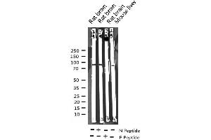 Western blot analysis of Phospho-ADAM 17 (Thr735) expression in various lysates (ADAM17 Antikörper  (pThr735))