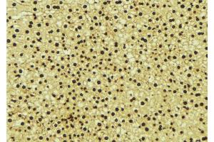 ABIN6276714 at 1/100 staining Mouse liver tissue by IHC-P.
