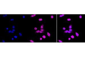Immunocytochemical staining of HAP-1 cells with PCBP1 antibody (ABIN7800958), 1:1,000). (Rekombinanter Poly Binding Protein 1 Antikörper)