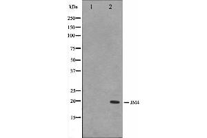 Western blot analysis on LOVO cell lysate using JM4 Antibody. (PRAF2 Antikörper  (C-Term))