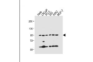 All lanes : Anti-PKN beta Antibody (C-term) at 1:500 dilution Lane 1: Hela whole cell lysate Lane 2: LNCaP whole cell lysate Lane 3: PC-3 whole cell lysate Lane 4: 293 whole cell lysate Lane 5: K562 whole cell lysate Lane 6: MCF-7 whole cell lysate Lysates/proteins at 20 μg per lane. (PKN beta Antikörper  (C-Term))