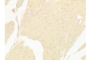 ABIN6259832 and ABIN6279098 at 1/100 staining human tongue carcinoma by IHC-P.