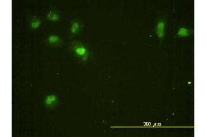 Immunofluorescence of monoclonal antibody to CDC2L5 on HeLa cell. (CDK13 Antikörper  (AA 1-324))