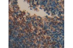 Immunohistochemistry (IHC) image for anti-Linker For Activation of T Cells Family, Member 2 (LAT2) (AA 29-193) antibody (ABIN5013879)