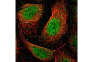 Immunofluorescent staining of U-2 OS with RARB polyclonal antibody  (Green) shows positivity in nucleus but excluded from the nucleoli. (Retinoic Acid Receptor beta Antikörper)