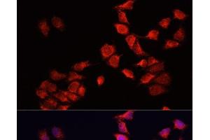 Immunofluorescence analysis of HeLa cells using BNIP3 Polyclonal Antibody at dilution of 1:100. (BNIP3 Antikörper)