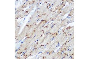 Immunohistochemistry of paraffin-embedded Rat heart using Connexin 43 Rabbit pAb (ABIN6131701, ABIN6141098, ABIN6141099 and ABIN6215448) at dilution of 1:100 (40x lens). (Connexin 43/GJA1 Antikörper  (AA 233-382))