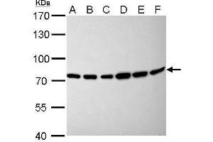 WB Image Moesin antibody [C2C3], C-term detects MSN protein by Western blot analysis.