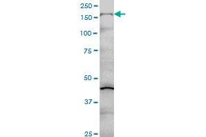 COL5A1 monoclonal antibody (M01), clone 2F4 Western Blot analysis of COL5A1 expression in Hela S3 NE . (COL5A1 Antikörper  (AA 1-591))