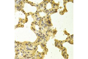 Immunohistochemistry (IHC) image for anti-TNFRSF1A-Associated Via Death Domain (TRADD) antibody (ABIN3021542) (TRADD Antikörper)