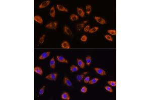 Immunofluorescence (IF) image for anti-Guanine Nucleotide Binding Protein (G Protein), beta Polypeptide 1 (GNB1) (AA 1-340) antibody (ABIN6141219)
