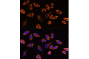 Immunofluorescence analysis of L929 cells using GNB1 Rabbit pAb (ABIN6129389, ABIN6141219, ABIN6141220 and ABIN6219000) at dilution of 1:100 (40x lens). (GNB1 Antikörper  (AA 1-340))