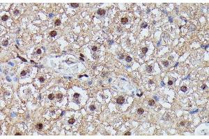 Immunohistochemistry of paraffin-embedded Mouse liver using IGHMBP2 Polyclonal Antibody at dilution of 1:100 (40x lens). (IGHMBP2 Antikörper)