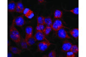 Immunofluorescence staining of vesicles (red) in RBL-2H3 rat basophilic leukemia cell line using anti-Kinesin (KN-03). (Kinesin (heavy chain) Antikörper)
