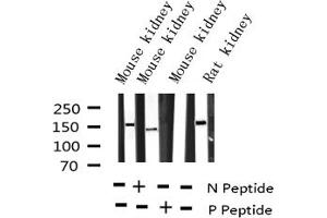 Western blot analysis of Phospho-VEGFR2 (Tyr951) expression in various lysates (VEGFR2/CD309 Antikörper  (pTyr951))