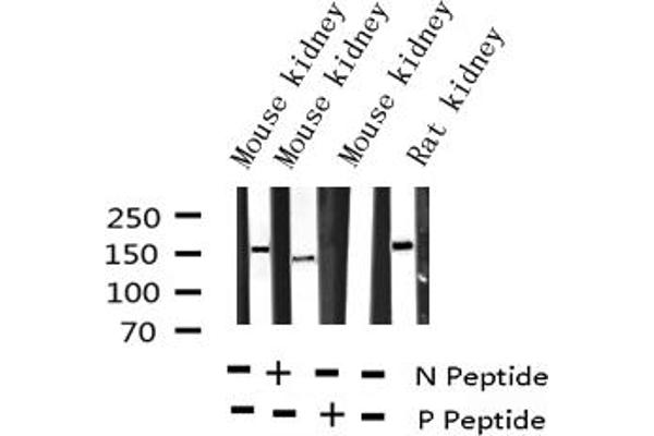 VEGFR2/CD309 antibody  (pTyr951)