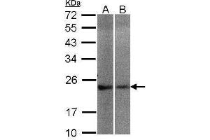 WB Image Sample(30 μg of whole cell lysate) A:A431, B:Hep G2, 12% SDS PAGE antibody diluted at 1:200