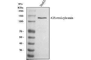 Western blot analysis of Ceruloplasmin using anti-Ceruloplasmin antibody (ABIN3044507). (Ceruloplasmin Antikörper  (AA 20-259))
