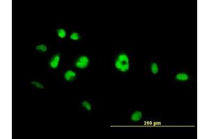 Immunofluorescence of monoclonal antibody to NR4A3 on HeLa cell.