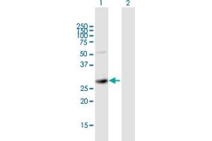 Western Blot analysis of SIRT5 expression in transfected 293T cell line by SIRT5 MaxPab polyclonal antibody. (SIRT5 Antikörper  (AA 1-310))