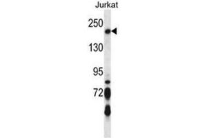 BRIP1 Antibody (N-term) western blot analysis in Jurkat cell line lysates (35µg/lane). (BRIP1 Antikörper  (N-Term))