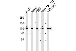 Western blot analysis of lysates from A431, Jurkat, K562, MDA-MB-231, U-251 MG cell line (from left to right), using ZNF175 Antibody at 1:1000 at each lane.