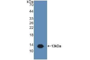 Detection of Recombinant TAPA1, Human using Polyclonal Antibody to Target Of The Antiproliferative Antibody 1 (TAPA1) (CD81 Antikörper  (AA 113-201))