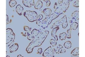 IHC analysis of EIF4A1 using anti-EIF4A1 antibody (ABIN7603144).