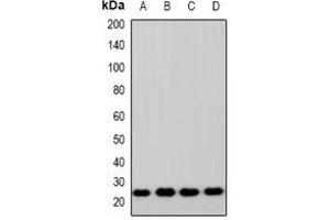 Western blot analysis of ZNRF2 expression in HEK293T (A), A549 (B), RAW264. (ZNRF2 Antikörper  (C-Term))