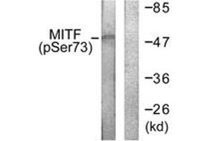Western blot analysis of extracts from COS7 cells, using MITF (Phospho-Ser180/73) Antibody. (MITF Antikörper  (pSer180))