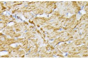 Immunohistochemistry of paraffin-embedded Rat heart using SLC25A5 Polyclonal Antibody at dilution of 1:100 (40x lens). (SLC25A5 Antikörper)