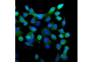 IF analysis of eRF1/ETF1 using anti-eRF1/ETF1 antibody (ABIN7602626). (ETF1 Antikörper  (AA 9-342))