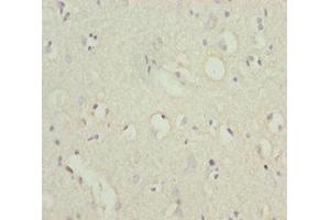Immunohistochemistry (IHC) image for anti-POU Domain, Class 4, Transcription Factor 3 (POU4F3) (AA 1-180) antibody (ABIN6098221)