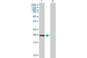 Western Blot analysis of MBD3L1 expression in transfected 293T cell line by MBD3L1 MaxPab polyclonal antibody. (MBD3L1 Antikörper  (AA 1-194))