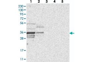 Western blot analysis of Lane 1: RT-4, Lane 2: U-251 MG, Lane 3: Human Plasma, Lane 4: Liver, Lane 5: Tonsil with OTUD6B polyclonal antibody  at 1:250-1:500 dilution. (OTUD6B Antikörper)