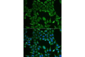 Immunofluorescence analysis of HeLa cells using CLPS antibody. (CLPS Antikörper)