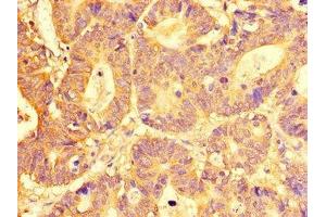 Immunohistochemistry (IHC) image for anti-Solute Carrier Family 29 (Nucleoside Transporters), Member 1 (SLC29A1) (AA 228-291) antibody (ABIN7151966)